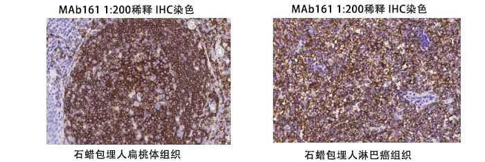 鼠抗人CD20抗體案例