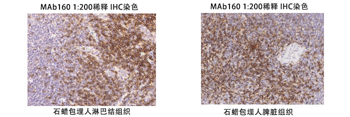 鼠抗人CD4抗體案例