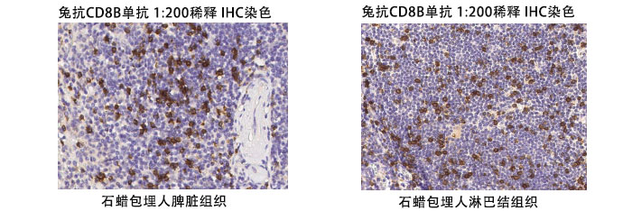 兔抗人CD8B抗體案例