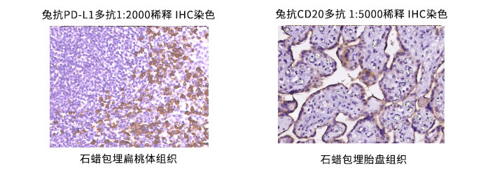 兔抗CD20多抗